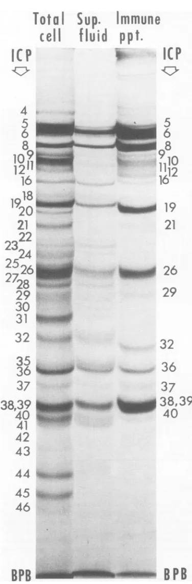FIG. 5.containing Autoradiograms of 8.5% polyacrylamide gels electrophoretically separated (i) total in-