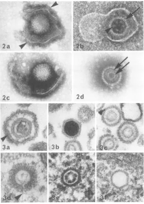 FIG.W~~~~~~~~~~.fsometimesstructurescapsomerescapsomeres(arrowhead), 2. Negatively stained HSV and CMV particles