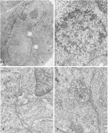 FIG. 6.perinuclearFIG. A single CMV capsid acquiring an envelope by budding through the inner nuclear cisterna
