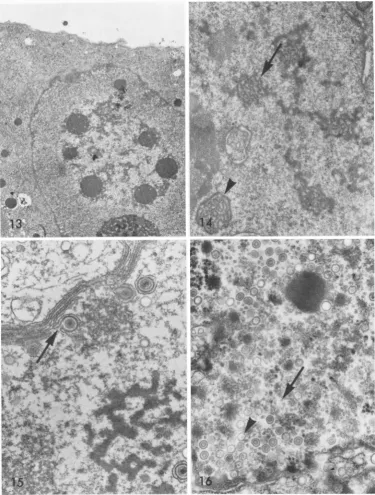 FIG. 15.nuclearpostinfection. A late HSV inclusionis present in the lower right. Note also the extensive reduplication of the membrane as well as the viruses acquiring an envelope at their inner face (arrow)