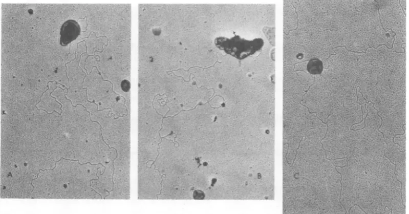 FIG. 4.28membrane min Electron micrographs of DNA associated with membranes. Electron microscopy of isolated DNA- complexes was carried out as described in Materials and Methods