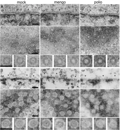FIG. 2. Electron microscopy of nuclear pores in infected cells. HeLa-3E cells were infected with mengovirus and poliovirus and ﬁxed at 4 h p.i.The upper rows in panels A and B correspond to cross-sectioned nuclear envelopes, the middle rows are tangentially cut nuclear envelopes in