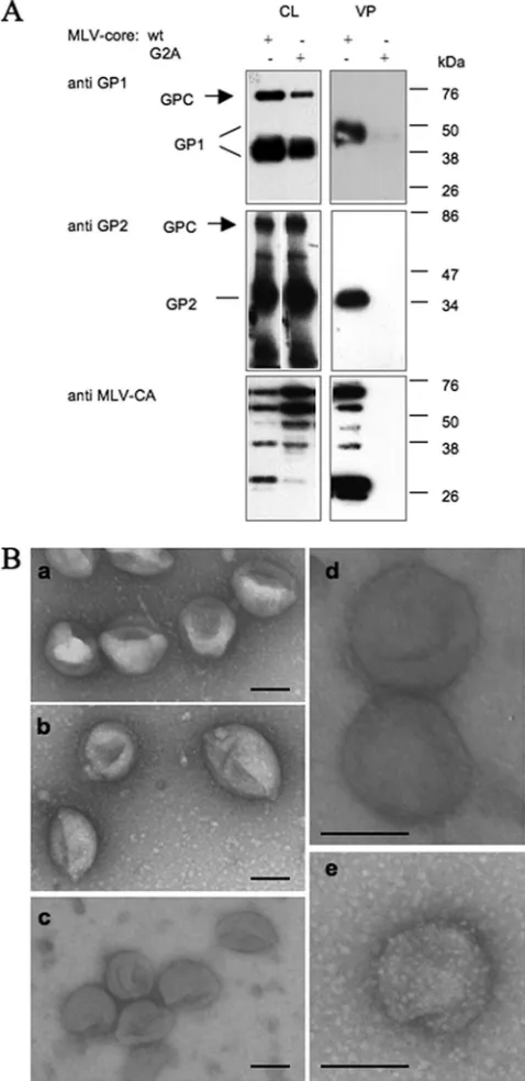 FIG. 1. Biochemical and electron microscopic analysis of LVpp.(A, left) Cell lysates (CL) of 293T cells transfected with LV GPC,