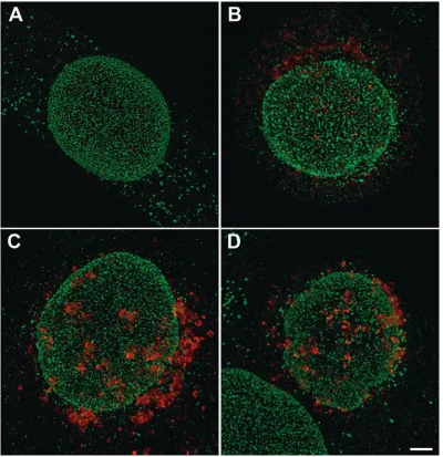 FIG. 12. Western blots of mock- and HSV-1-infected HeLa cells 0to 24 h postinoculation as described in Materials and Methods using