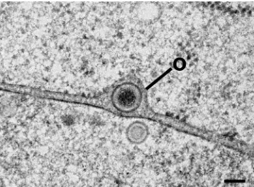 FIG. 10. Number of budding capsids per �m2 at the nuclear enve-lope at 8, 10, and 15 h of incubation.