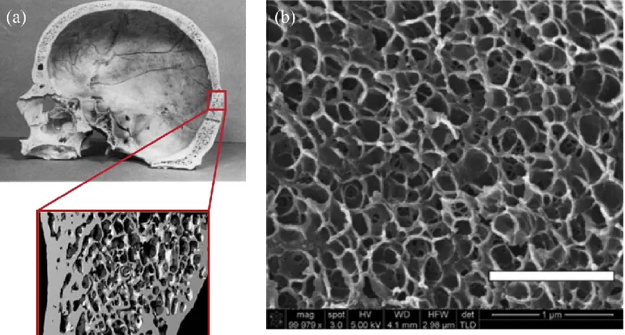Figure 1-4: (a) Bone showing microscale random arrangement of constituent elements.21 (b) Polymer foam with random structure