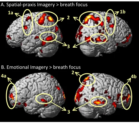 Figure 5.  Brain rendering of areas that showed activity during (A) spatial praxis 