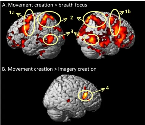 Figure 6: Brain rendering of areas that showed greater activity during static movement 