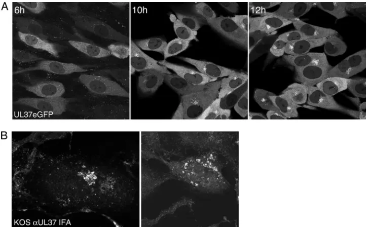 FIG. 3. UL37eGFP localizes to a juxtanuclear site. (A) HFT cell monolayers (6 �at an MOI of 10 PFU/cell and the cells visualized with a Zeiss LSM 510 Meta confocal microscope at 6, 10, and 12 h postinfection