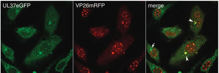 FIG. 5. UL37eGFP trafﬁcs to the Golgi complex before capsids are transported to the same site