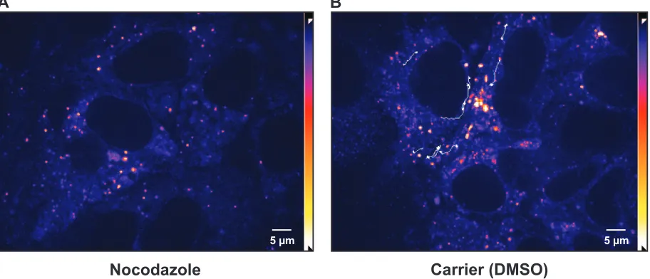 FIG. 6. Saltatory movement of small HCV RCs is MT dependent. Huh-7.5-I/5A-GFP-6 cells were cultured in the presence of 20 �Long-distance saltatory movement events were tracked as speciﬁed in Materials and Methods