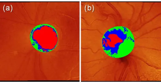 Figure 1.10 HRT II topography images for eyes in Figure 1.8 with overlay of 