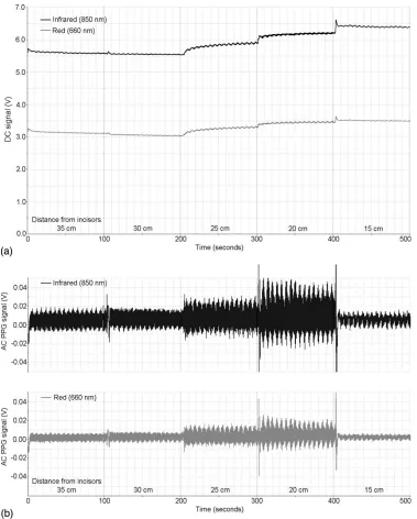 Fig. 4 Example of a 100-s recording of the dc (a) and normalized ac PPG (b) infrared and red signals at all ﬁve measurement depths for one patient(patient number = 17).