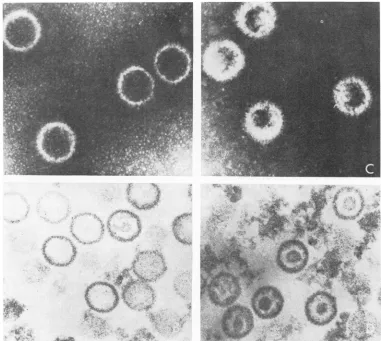 FIG. 2.niegativelysectionted100 Electront micrographs oftop (A and B) and bottom (C and D) band, HS V-2 capsids
