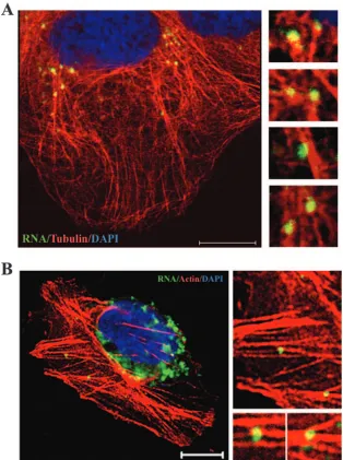 FIG. 4. Colocalization of HCV RNA with microtubules (A) and actin ﬁlaments (B) in HCV replicon cells