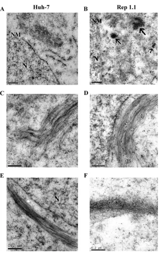 FIG. 6. Immunoelectron microscopy of NS5A-associated microtubules and actin ﬁlaments. Huh-7 (A, C, and E) or Rep 1.1 (B, D, and F) cellslabeled with Ab against NS5A are shown