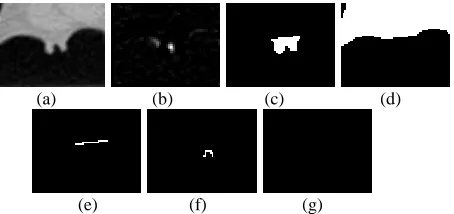 Fig. 4 Two-step ICV orifice detection example. (a) CT sub-image; (b) the difference image based on negative k2 PDE; (c) the protruding object extracted based on critical points [3]; (d) the 