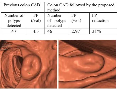 Table 3 . The comparative colon CAD performance before and after the proposed method on the testing dataset   