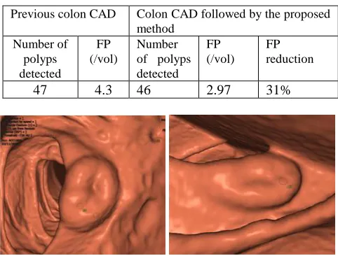 Table 3 . The comparative colon CAD performance before and after the proposed method on the testing dataset   