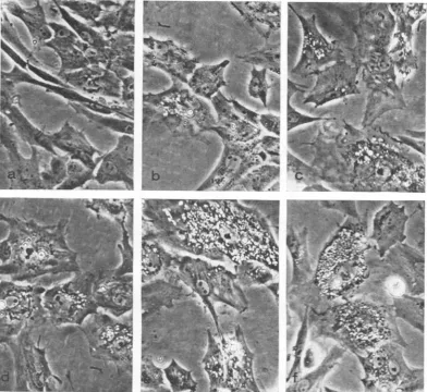 FIG. 2.anidshifted Effects of temperature shift otn morphology ofRSV-BH-Ta iiifected cells
