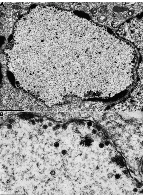 FIG. 5. Ultrastructural analysis of PrV-�after infection. (A) Overview of an infected cell; (B) higher-magniﬁcation view of intranuclear capsids