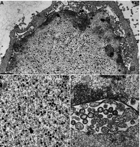 FIG. 6. Ultrastructural analysis of HSV1-�analyzed 20 h after infection. (A) Overview of an infected cell; (B) higher-magniﬁcation view of intranuclear capsids; (C) vesicles within theperinuclear cleft