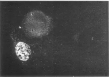 FIG. 5.diumn.treated Inmunofiluorescence photomicrograph cf EBV antigenis localized in the cytoplasm in D98/HR-J cells with 40 ,ug of S-IUDR/ml f