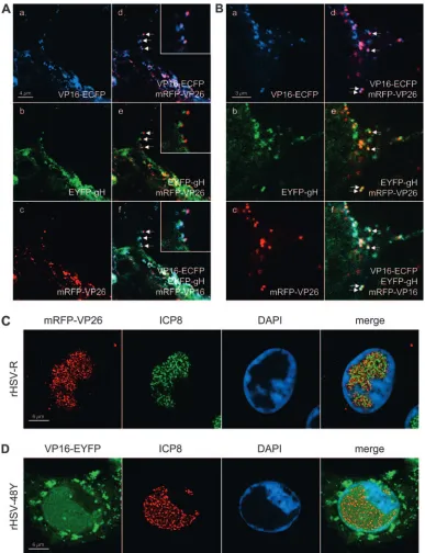 FIG. 6. High-resolution CLSM of rHSV-RYC-infected cells and rHSV-R- and rHSV-48Y-infected cells stained for ICP8