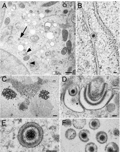 FIG. 10. Electron micrographs of Vero cells infected with rHSV-RYC after preﬁxation at 24 h p.i