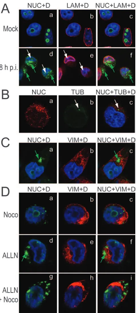 FIG. 6. Aggregated nucleolin has the characteristics of aggresomes.(A) Aggregated nucleolin has a cytoplasmic localization