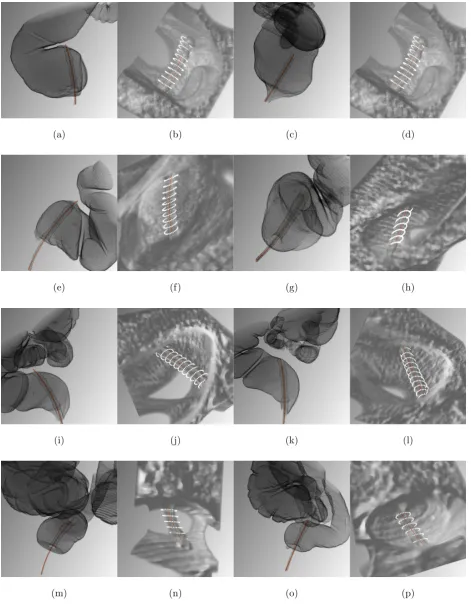 FIG. 10: The visualization of RT detection. Each row shows a patient respectively, the