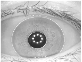 Fig. 7: 5 level Haar Wavelet decomposition applied to normalized iris image  