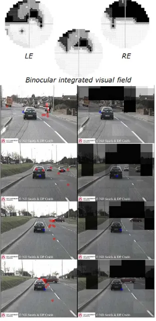 Figure 3. Visual fields, dynamic ‘point of regard’ and HPT films – example. HFA grayscales for monocular (30-2) and binocular integratedvisual fields for one of the participants with bilateral glaucoma