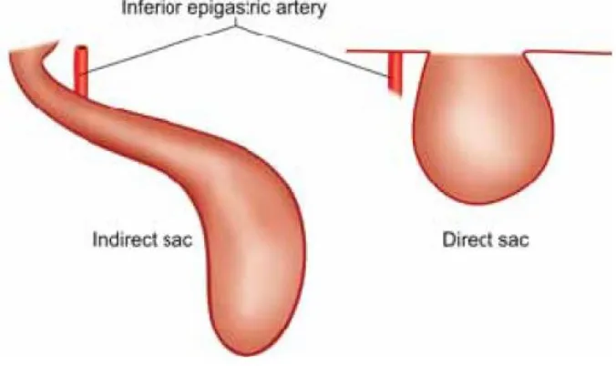 Fig 4:  Anatomical relations and locations of the inguinal, femoral and obturator hernias