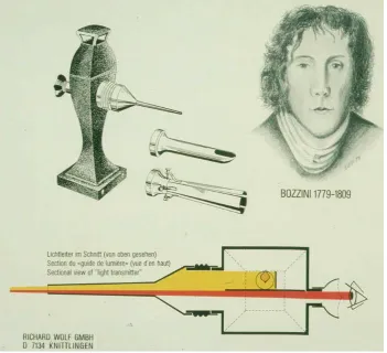 Fig 2: Philip Bozzini and the early endoscope “Lichtleiter”, Adapted from Google Images 