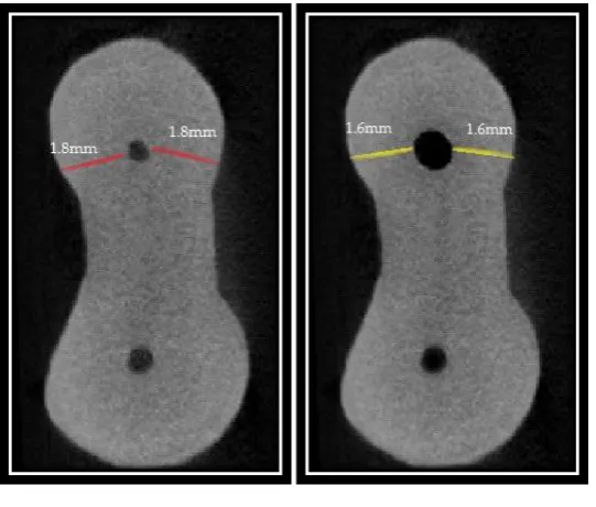 FIGURE 13:  MICRO-CT IMAGE AT 3MM FROM APEX HEDM GROUP  