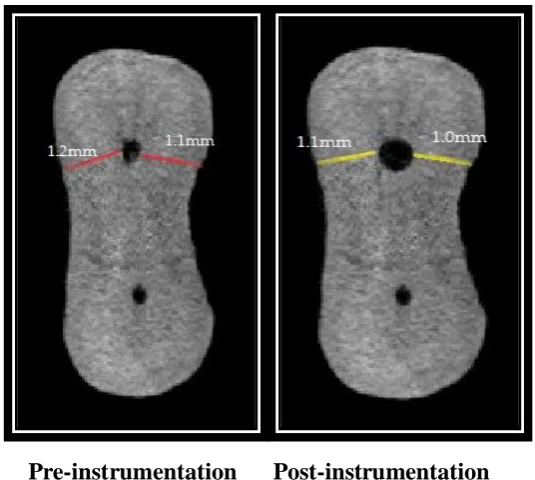 FIGURE 15:  MICRO-CT IMAGE AT 9MM FROM APEX HEDM GROUP  