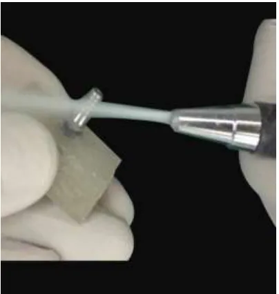 Fig.56: Complete embedding of implant-abutment assembly 