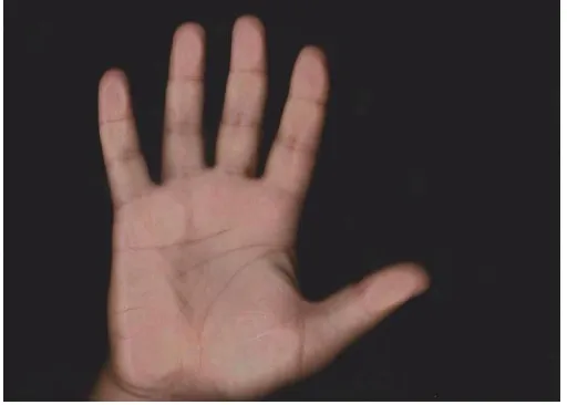 Fig 1. Image of Hand 
