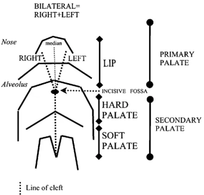 Figure 1 Schematic representation of the lip and palate to explain the classification systems.