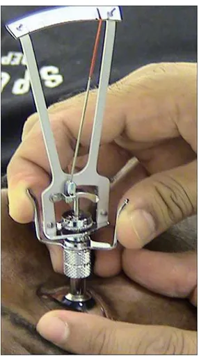 Figure 6 : Goldmann Applanation tonometry 