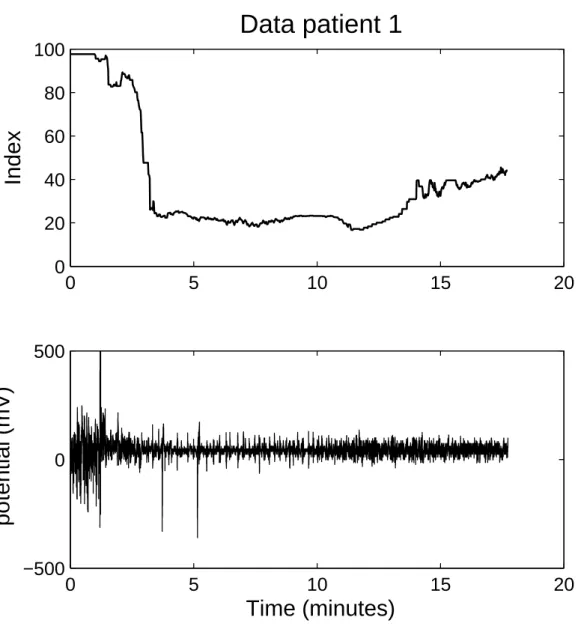 Figure 4.1: Data for patient one. The upper figure show the BIS index. The lower figure contain the raw EEG.