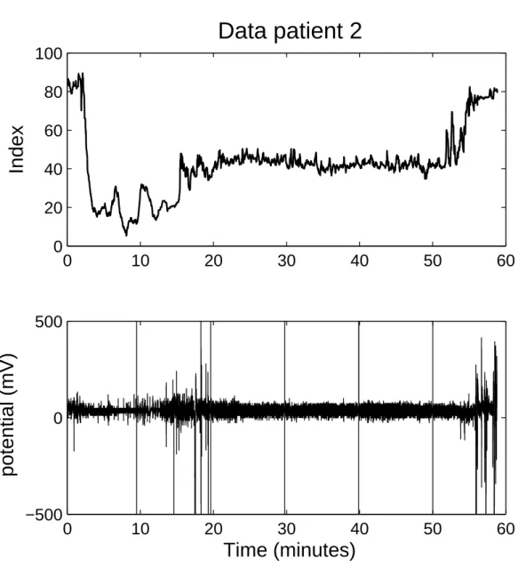 Figure 4.2: Data for patient two. The upper figure show the BIS index. The lower figure contain the raw EEG.