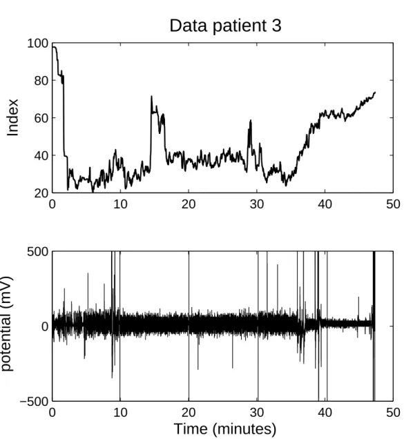 Figure 4.3: Data for patient three. The upper figure show the BIS index. The lower figure contain the raw EEG.