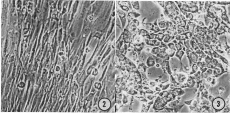FIG.1. Immature C-type particles in leukemic lymphoblasts budding from endoplasmic reticulum