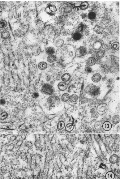 FIG. 13.ofcore. nucleoprotein Section ofan infected nuclei. X84,000. (a) Fibrous rod resembling viral nucleoprotein