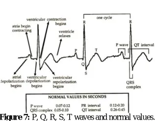 Figure 7:  P, Q, R, S, T waves and normal values.  