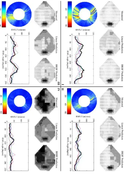 Figure 2. Model predictions for four cases from the Blue Mountains Eye Study dataset. For 