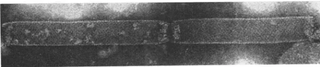 FIG. freeingempty spherical membrcanies ormenited 6. Outer membranies are from thick rod-shaped particles as membranles
