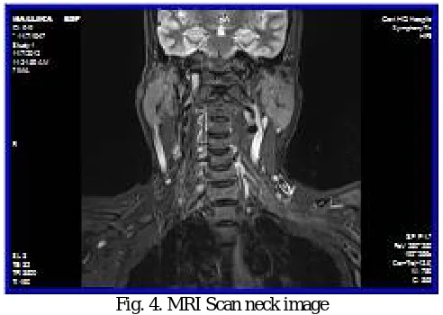 Fig. 4. MRI Scan neck image  